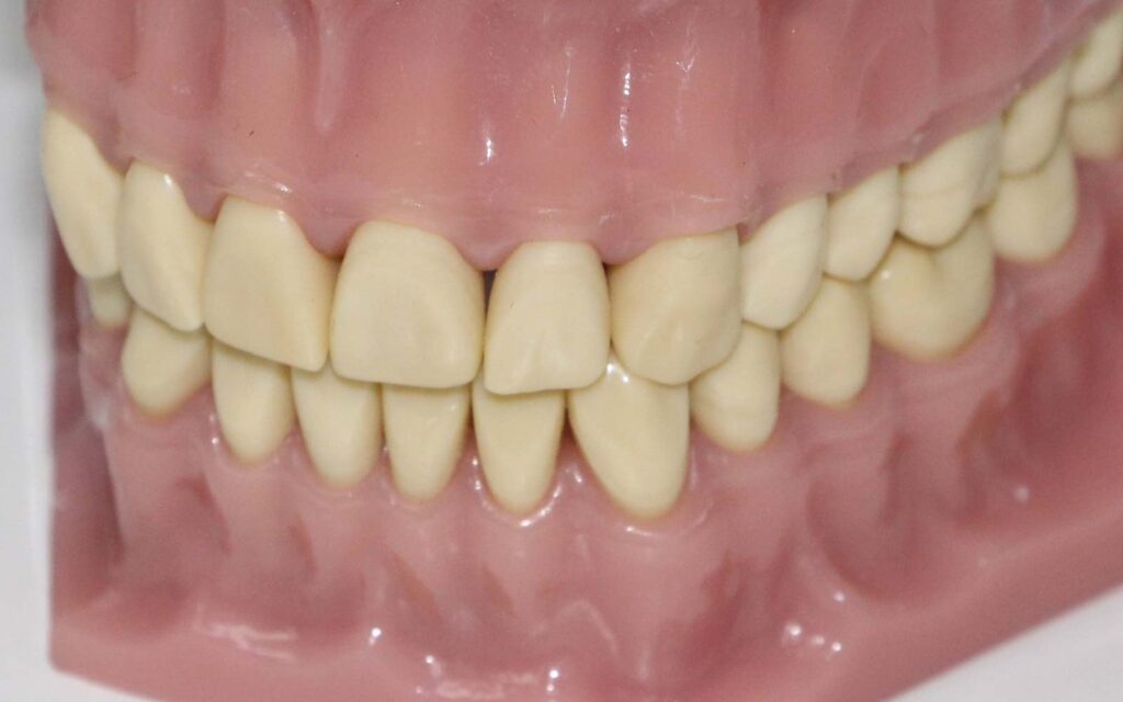 Maquette de dents humaines montrant une teinte ivoire naturelle et non parfaitement blanche